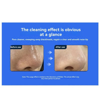 Electric Blackhead Remover Vacuum Pore Cleaner Facial Acne Extractor