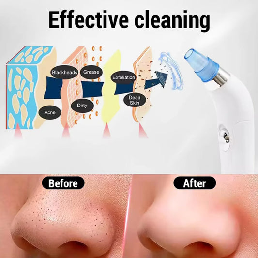 Electric Blackhead Remover Vacuum Pore Cleaner Facial Acne Extractor